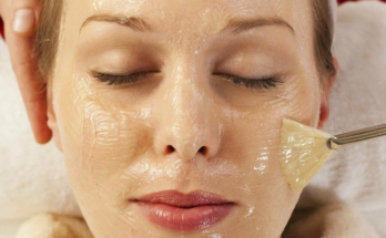 chemical peel treatment in Pakistan