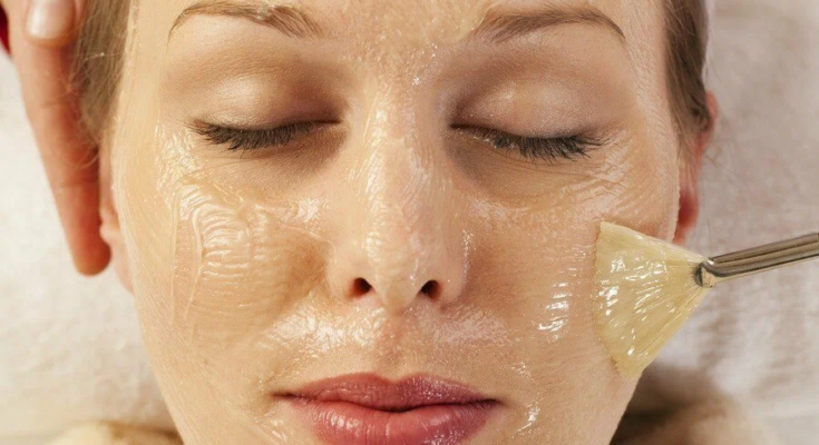 chemical peel treatment in Pakistan