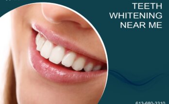 Teeth Whitening Near Me