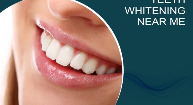 Teeth Whitening Near Me