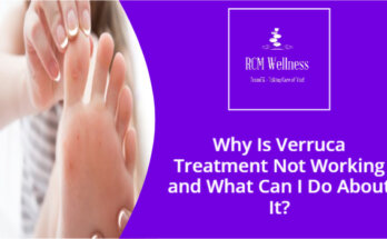 Verruca Treatment