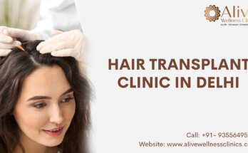 Hair Transplant Clinic in Delhi