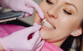 Top Benefits of Choosing a Skilled Cosmetic Dentist for You