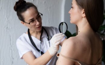 skin cancer clinic sydney cbd